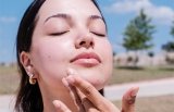 6 Causes of Summer Breakouts (and What to Do About Them!)